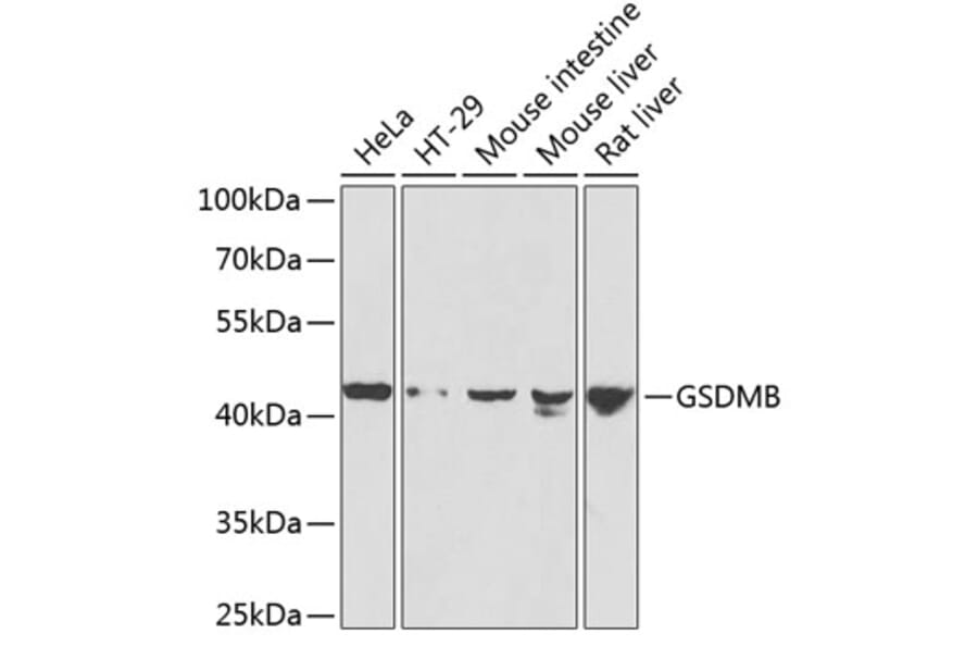Western Blot - Anti-GSDMB Antibody (A7474) - Antibodies.com