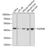 Western Blot - Anti-GSDMB Antibody (A7474) - Antibodies.com