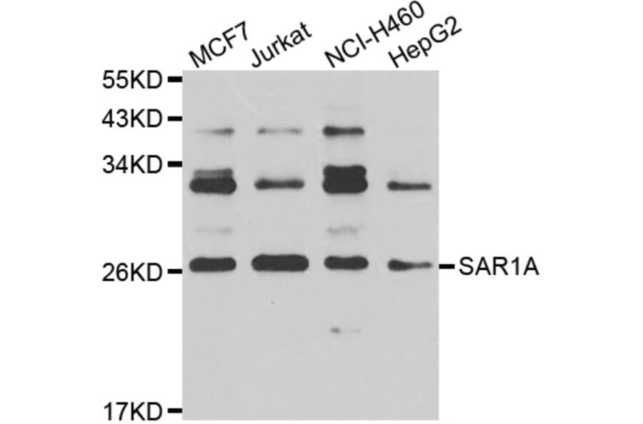 Western Blot - Anti-SAR1A Antibody (A7476) - Antibodies.com