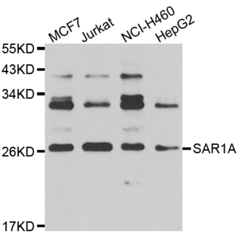 Western Blot - Anti-SAR1A Antibody (A7476) - Antibodies.com