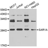 Western Blot - Anti-SAR1A Antibody (A7476) - Antibodies.com