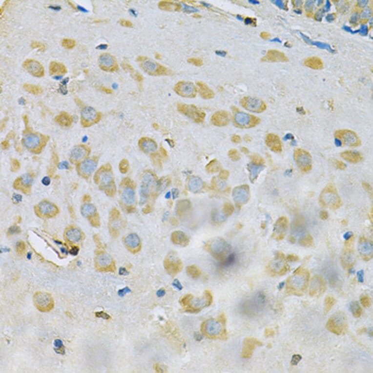 Immunohistochemistry - Anti-SAR1A Antibody (A7476) - Antibodies.com