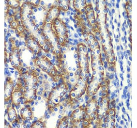 Immunohistochemistry - Anti-ZFAND3 Antibody (A15728) - Antibodies.com