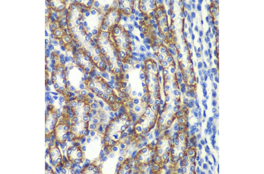 Immunohistochemistry - Anti-ZFAND3 Antibody (A15728) - Antibodies.com