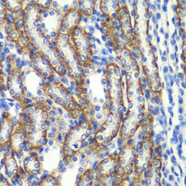 Immunohistochemistry - Anti-ZFAND3 Antibody (A15728) - Antibodies.com