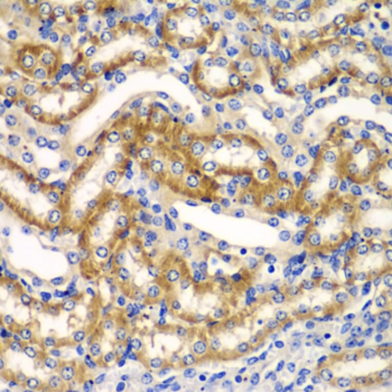 Immunohistochemistry - Anti-ZFAND3 Antibody (A15728) - Antibodies.com