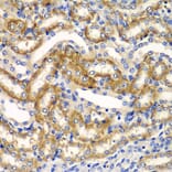Immunohistochemistry - Anti-ZFAND3 Antibody (A15728) - Antibodies.com