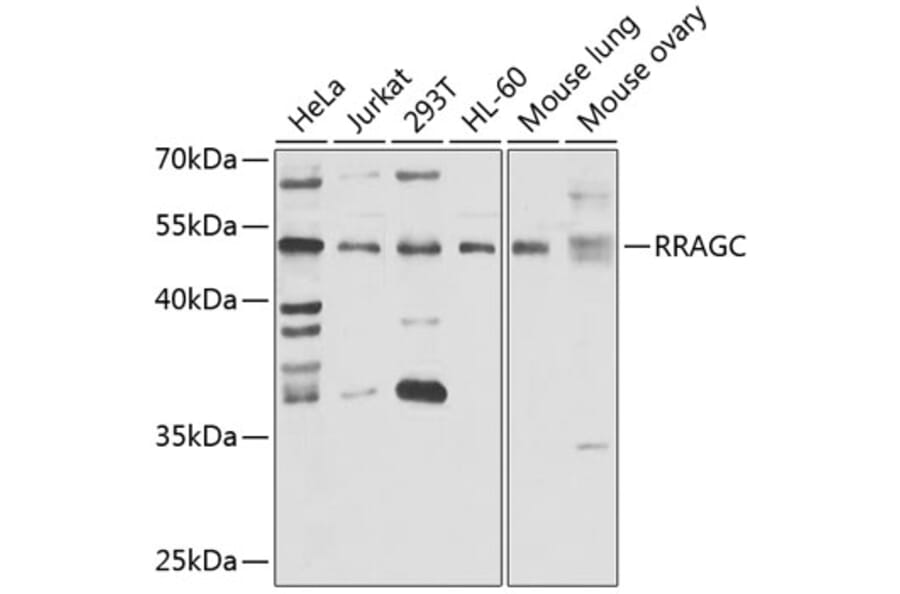Western Blot - Anti-RRAGC Antibody (A15729) - Antibodies.com