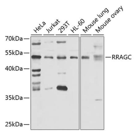 Western Blot - Anti-RRAGC Antibody (A15729) - Antibodies.com