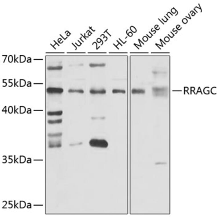 Western Blot - Anti-RRAGC Antibody (A15729) - Antibodies.com