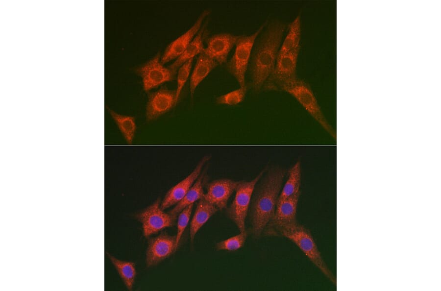 Immunofluorescence - Anti-MTMR14 Antibody (A15730) - Antibodies.com