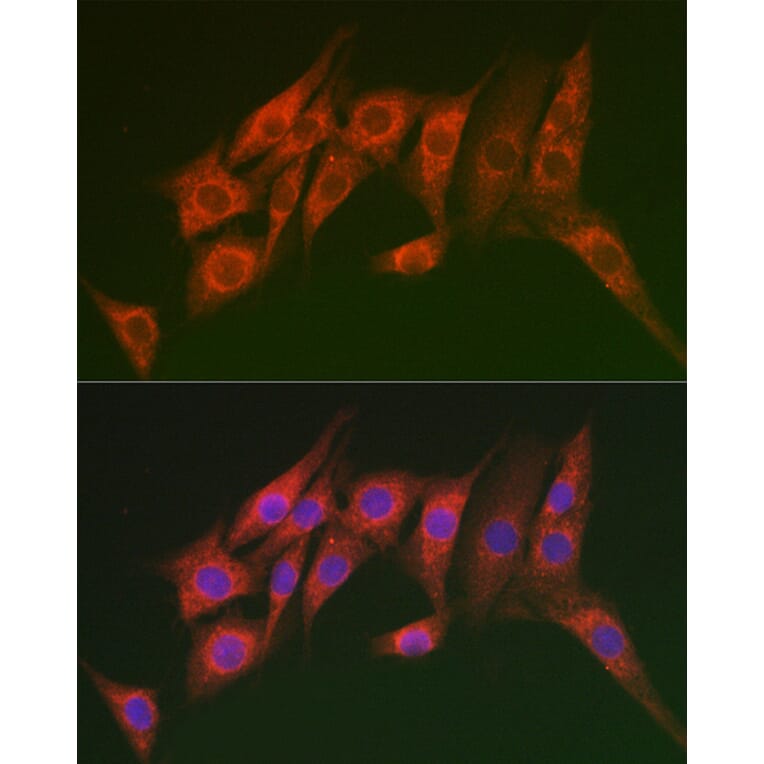 Immunofluorescence - Anti-MTMR14 Antibody (A15730) - Antibodies.com