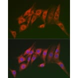 Immunofluorescence - Anti-MTMR14 Antibody (A15730) - Antibodies.com