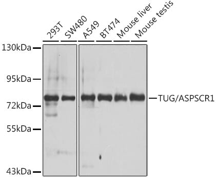 Western blot analysis of extracts of various cell lines, using Anti-ASPSCR1 Antibody (A7481) at 1:1,000 dilution.
Secondary antibody: Goat Anti-Rabbit IgG (H+L) (HRP) (AS014) at 1:10,000 dilution.
Lysates / proteins: 25µg per lane.
Blocking buffer: 3% non-fat dry milk in TBST.
Detection: ECL Basic Kit (RM00020).
Exposure time: 30s.