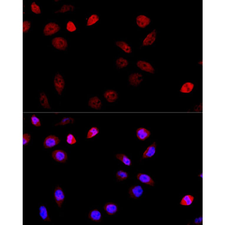 Immunofluorescence - Anti-TUG Antibody (A15731) - Antibodies.com