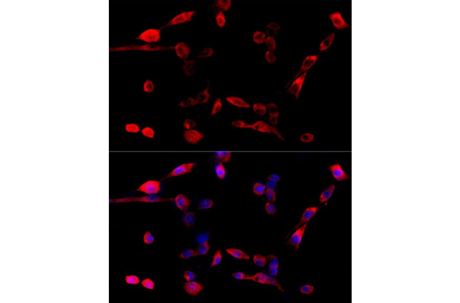 Immunofluorescence - Anti-TUG Antibody (A15731) - Antibodies.com