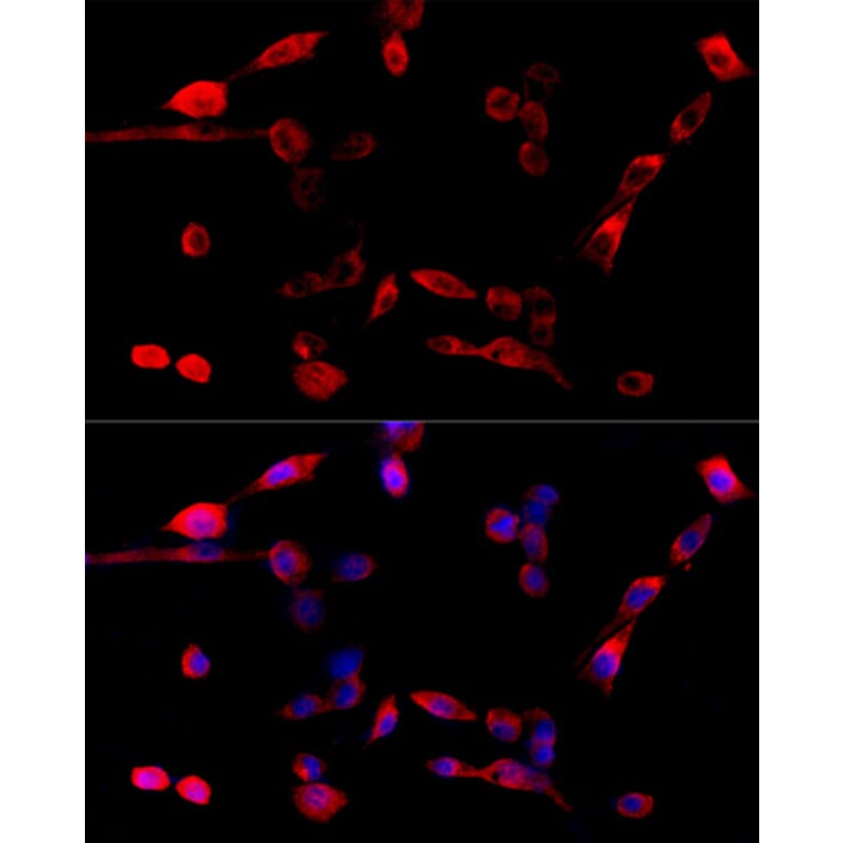 Immunofluorescence - Anti-TUG Antibody (A15731) - Antibodies.com
