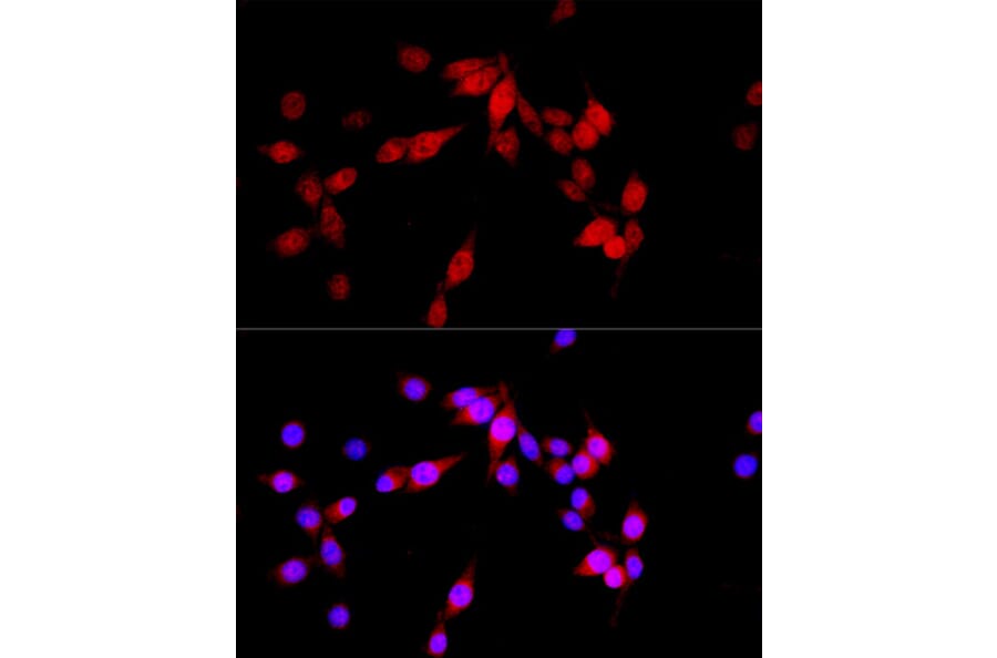 Immunofluorescence - Anti-TUG Antibody (A15731) - Antibodies.com