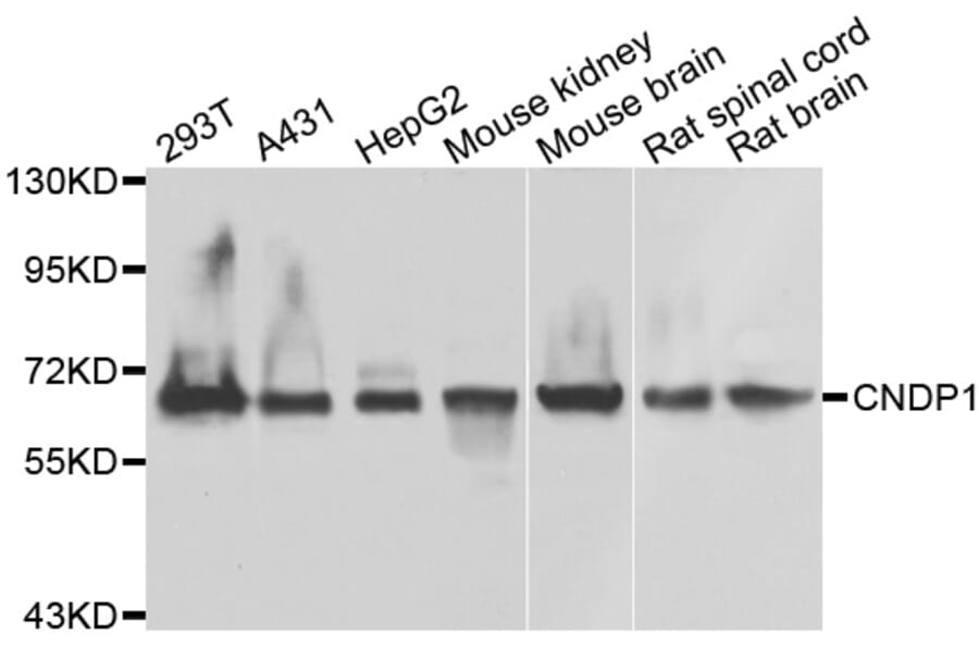 Western Blot - Anti-CNDP1 Antibody (A7485) - Antibodies.com