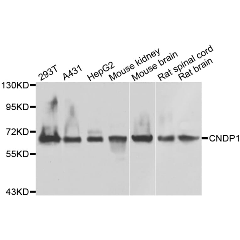 Western Blot - Anti-CNDP1 Antibody (A7485) - Antibodies.com