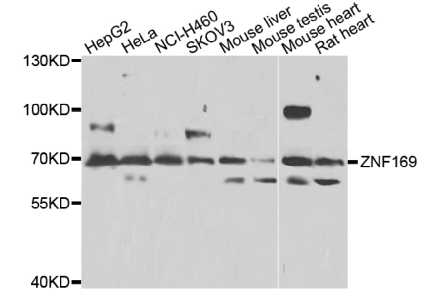 Western Blot - Anti-ZNF169 Antibody (A7486) - Antibodies.com