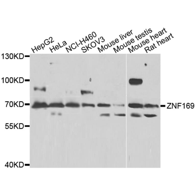 Western Blot - Anti-ZNF169 Antibody (A7486) - Antibodies.com