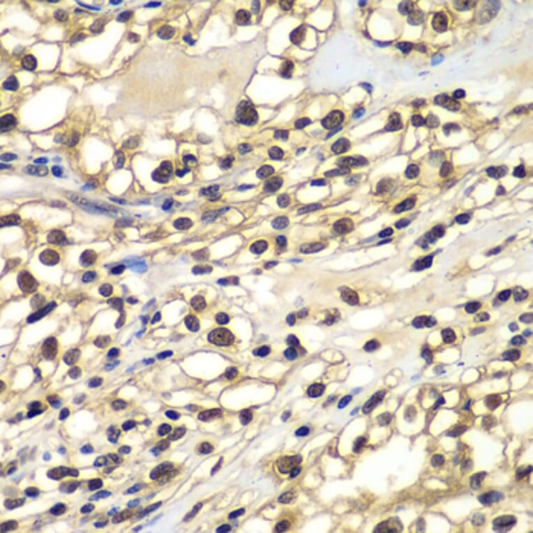 Immunohistochemistry - Anti-ZNF169 Antibody (A7486) - Antibodies.com