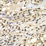 Immunohistochemistry - Anti-ZNF169 Antibody (A7486) - Antibodies.com