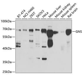 Western Blot - Anti-GNS Antibody (A15735) - Antibodies.com