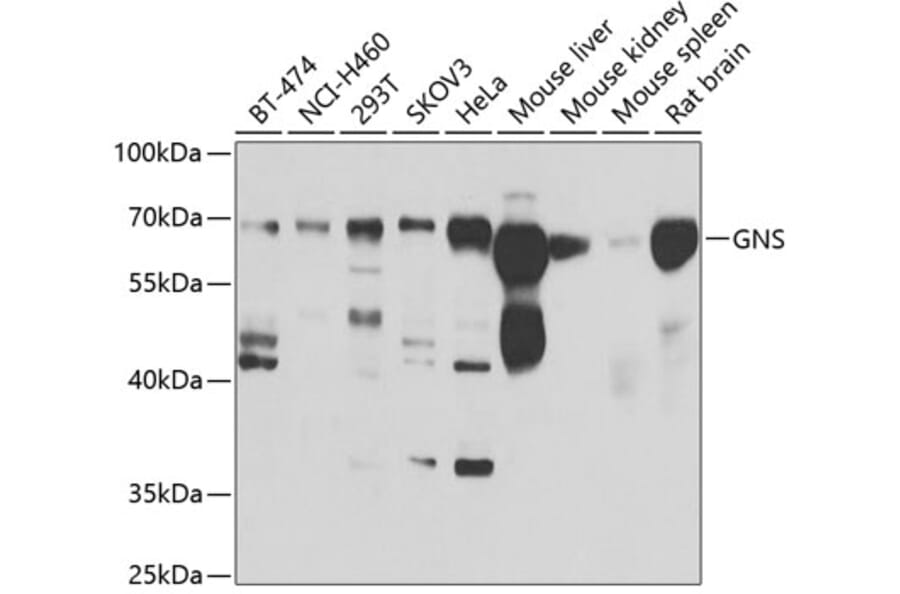 Western Blot - Anti-GNS Antibody (A15735) - Antibodies.com