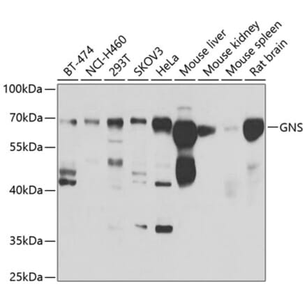 Western Blot - Anti-GNS Antibody (A15735) - Antibodies.com