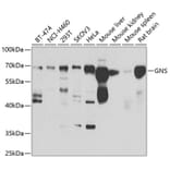 Western Blot - Anti-GNS Antibody (A15735) - Antibodies.com