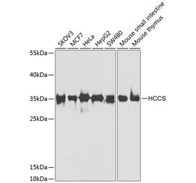 Western Blot - Anti-HCCS Antibody (A15736) - Antibodies.com
