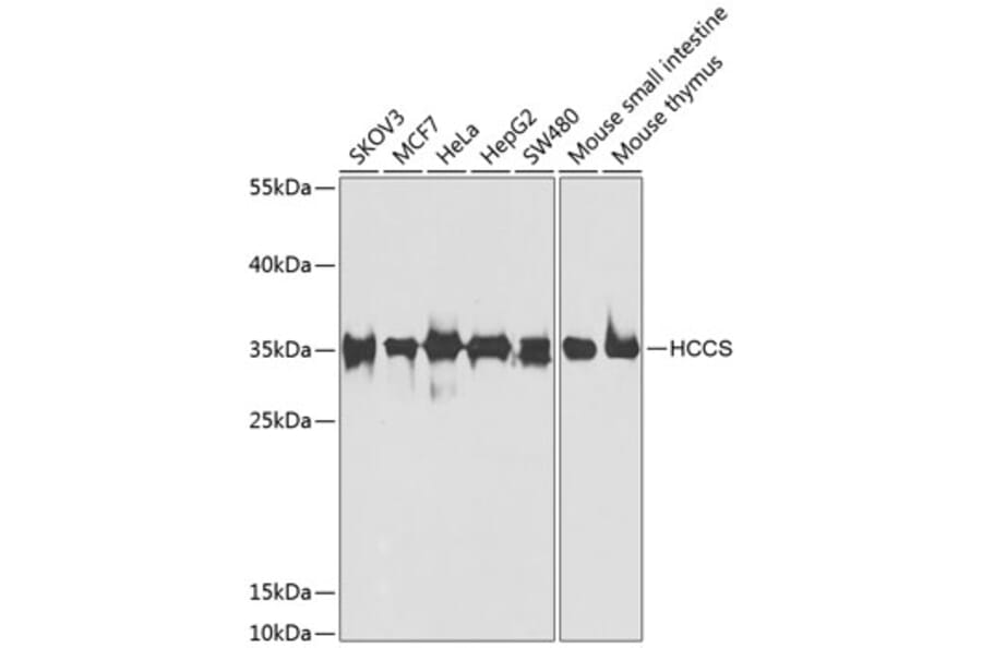 Western Blot - Anti-HCCS Antibody (A15736) - Antibodies.com