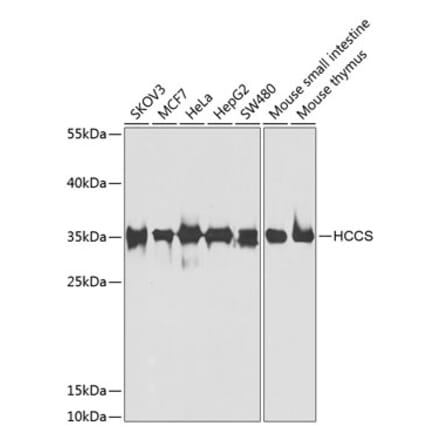 Western Blot - Anti-HCCS Antibody (A15736) - Antibodies.com