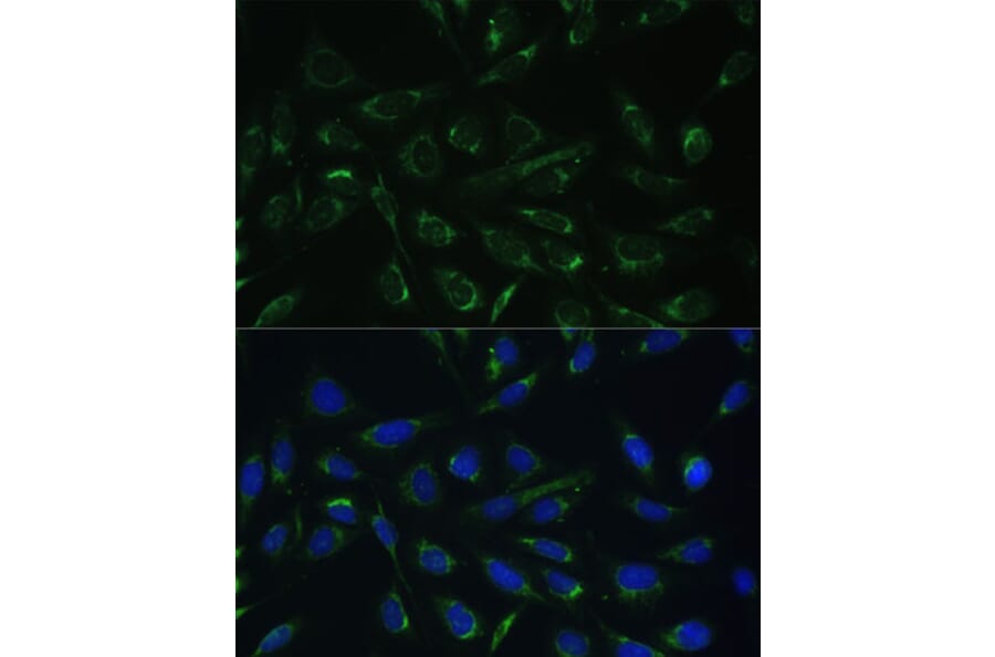 Immunofluorescence - Anti-HCCS Antibody (A15736) - Antibodies.com