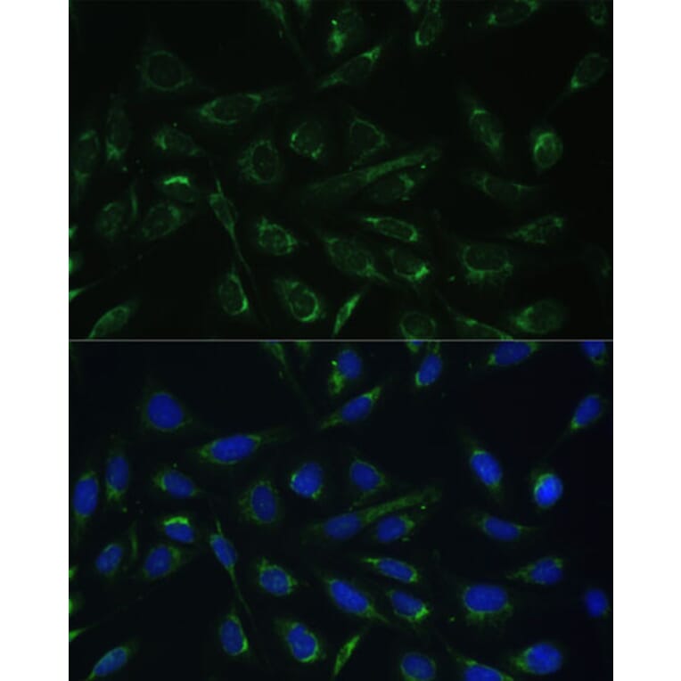 Immunofluorescence - Anti-HCCS Antibody (A15736) - Antibodies.com