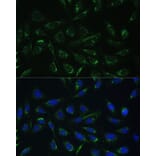 Immunofluorescence - Anti-HCCS Antibody (A15736) - Antibodies.com