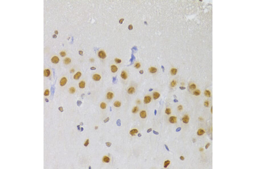 Immunohistochemistry - Anti-hnRNP A1 Antibody (A15737) - Antibodies.com