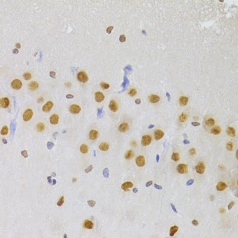 Immunohistochemistry - Anti-hnRNP A1 Antibody (A15737) - Antibodies.com