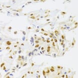 Immunohistochemistry - Anti-hnRNP A1 Antibody (A15737) - Antibodies.com