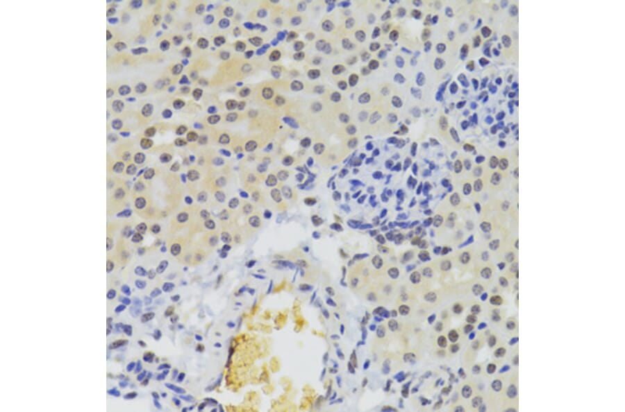 Immunohistochemistry - Anti-hnRNP A1 Antibody (A15737) - Antibodies.com