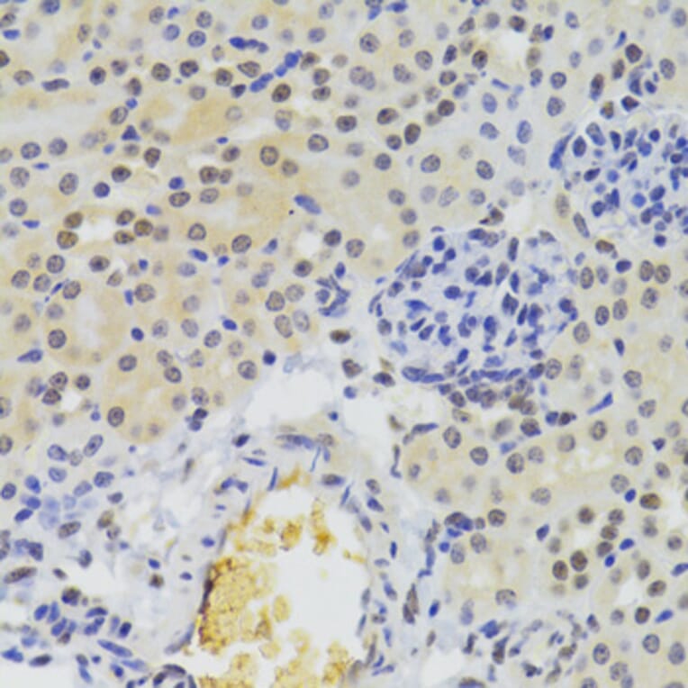 Immunohistochemistry - Anti-hnRNP A1 Antibody (A15737) - Antibodies.com