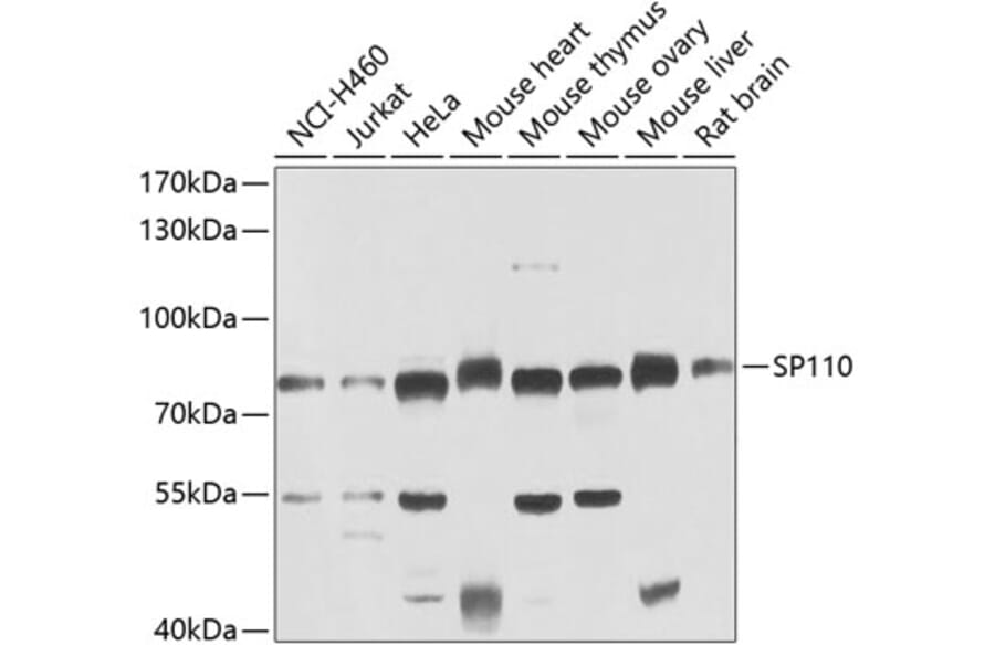 Western Blot - Anti-SP110 Antibody (A15738) - Antibodies.com