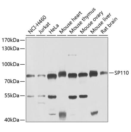 Western Blot - Anti-SP110 Antibody (A15738) - Antibodies.com