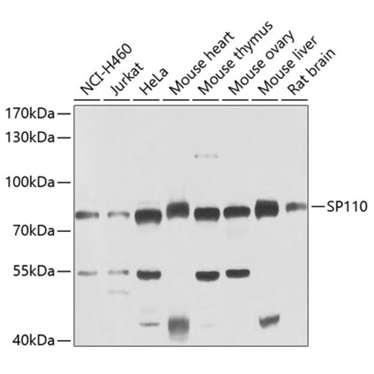 Western Blot - Anti-SP110 Antibody (A15738) - Antibodies.com