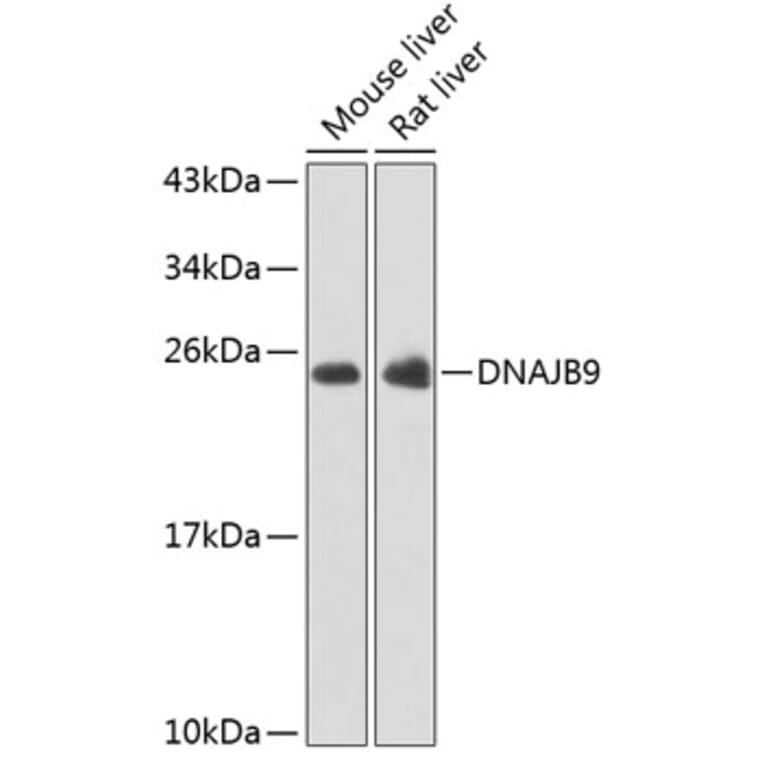 Western Blot - Anti-DNAJB9 Antibody (A15739) - Antibodies.com
