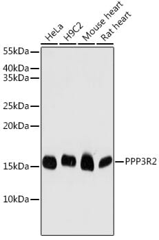 Western blot analysis of extracts of various cell lines, using Anti-PPP3R2 Antibody (A7495) at 1:1,000 dilution.
Secondary antibody: Goat Anti-Rabbit IgG (H+L) (HRP) (AS014) at 1:10,000 dilution.
Lysates / proteins: 25µg per lane.
Blocking buffer: 3% non-fat dry milk in TBST.
Detection: ECL Basic Kit (RM00020).
Exposure time: 90s.