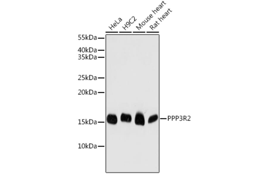 Western Blot - Anti-Calcineurin BII/PPP3R2 Antibody (A15740) - Antibodies.com