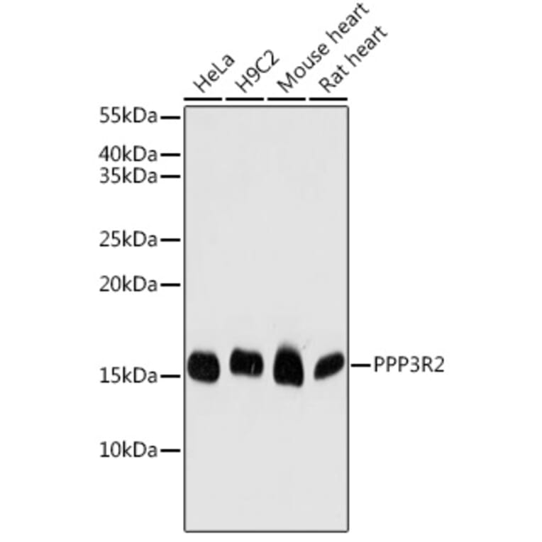 Western Blot - Anti-Calcineurin BII/PPP3R2 Antibody (A15740) - Antibodies.com